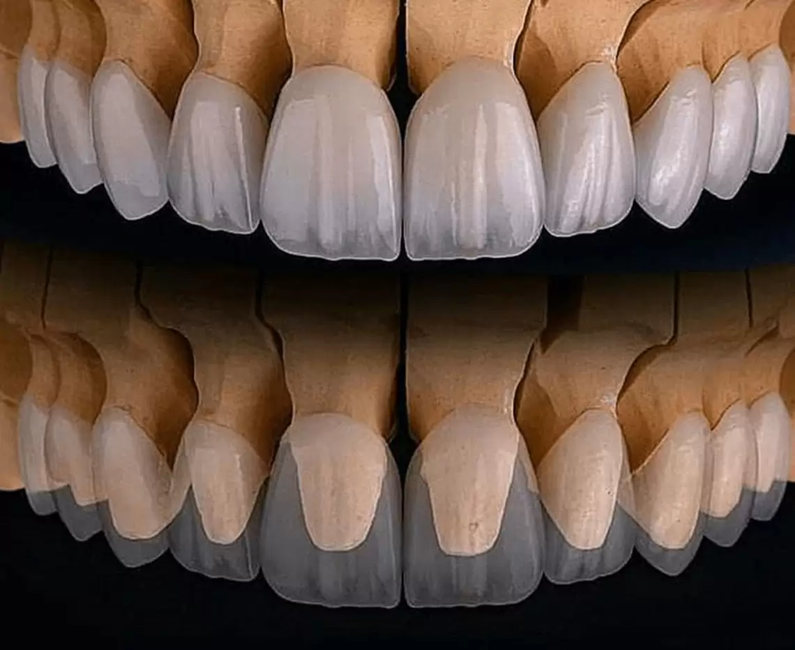 Zirconia Crown & Bridge